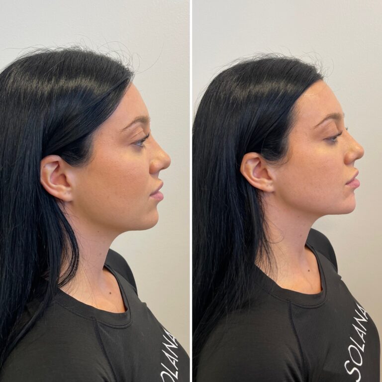 botox downers grove il