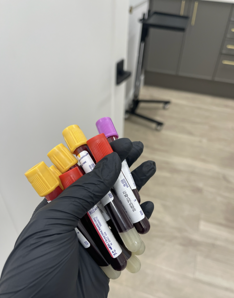 The Best PRP Facial in Downers Grove